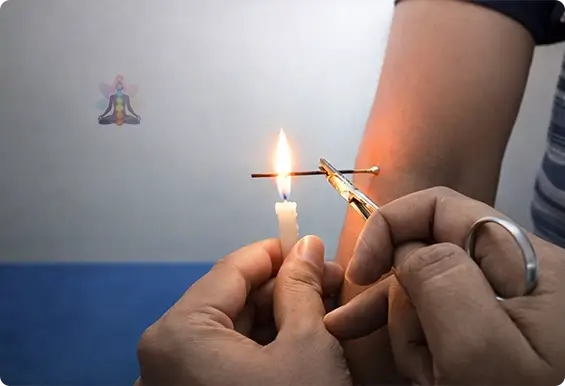 Agni Karma Therapy